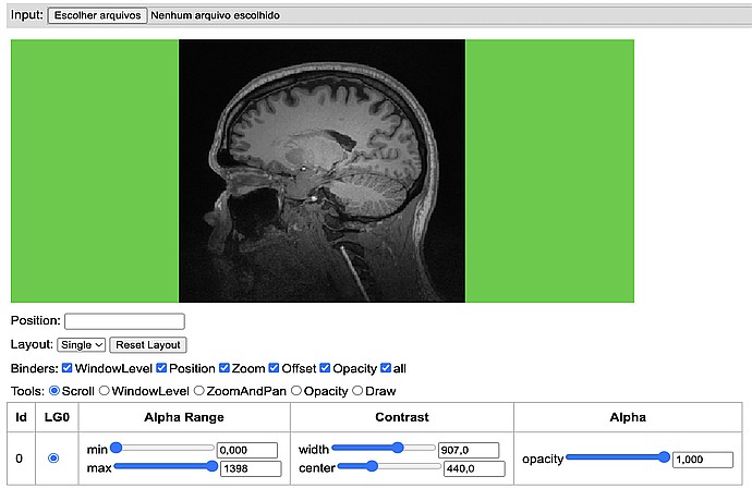 Brain MRI Imaging Interface