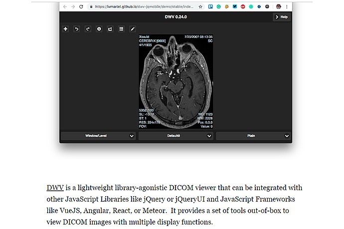 DICOM Web Viewer (DWV) Description
